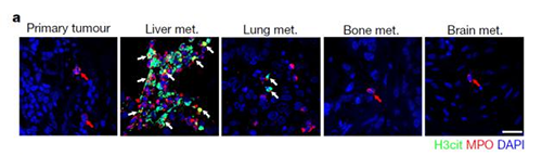 转入小鼠模子获得相同的试验效果，，，且在转移爆发前NET已在肝脏聚积。。。。。