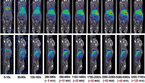 CC网投PET/CT分子影像手艺平台