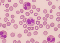 一种神秘颗粒被发明了！它能否成为败血症早筛标记物？？？？？