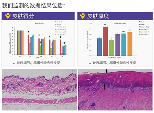 CC网投建设的特应性皮炎及湿疹模子监测数据效果